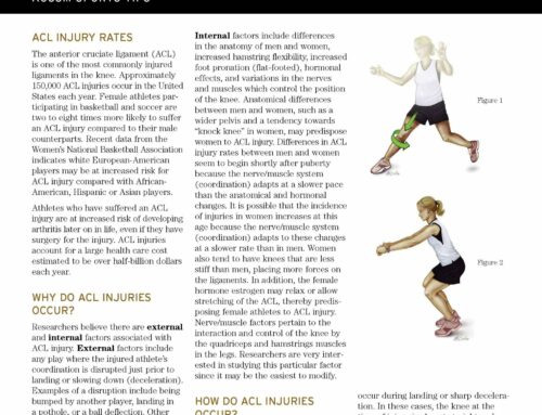 ACL Injury PreventionAC